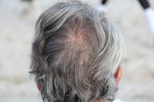 Greying Hair